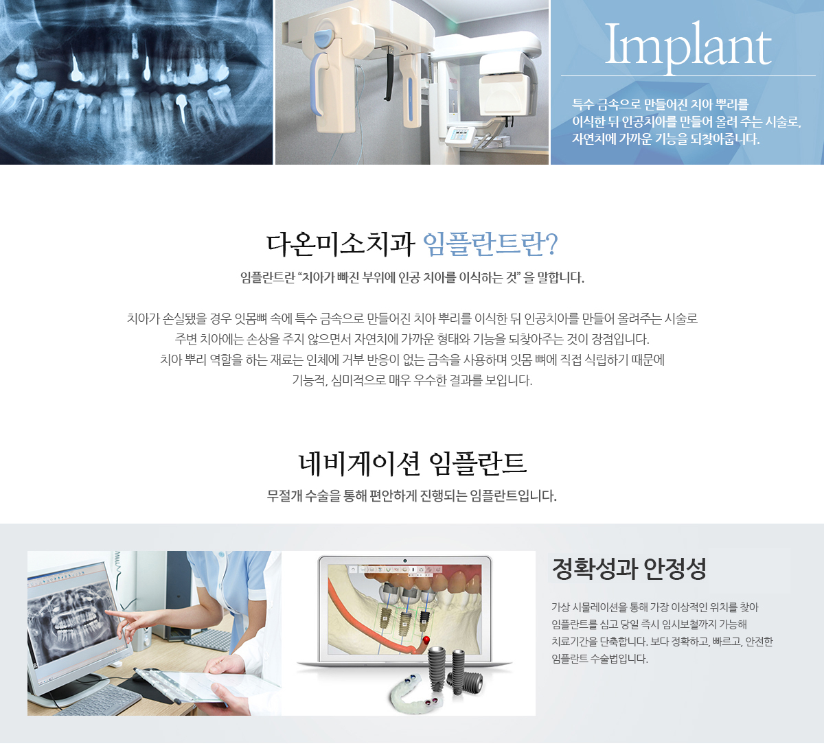 다온미소 임플란트란?