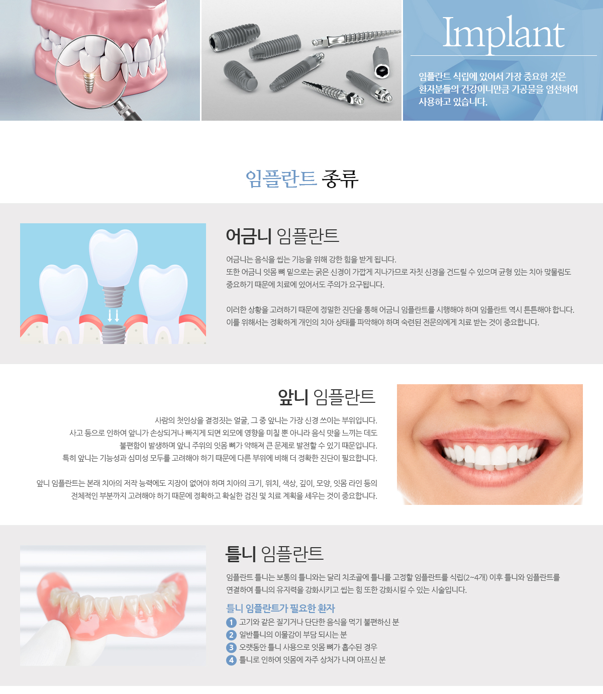임플란트 종류