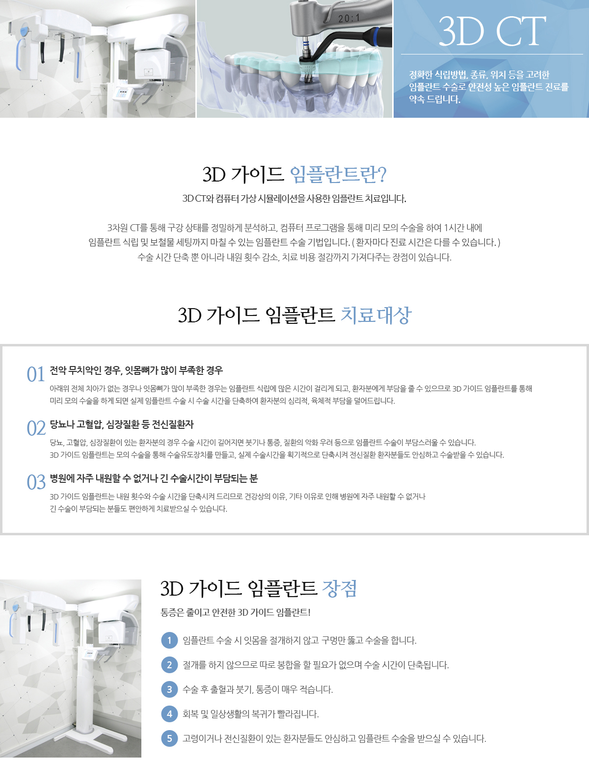 3D가이드 임플란트