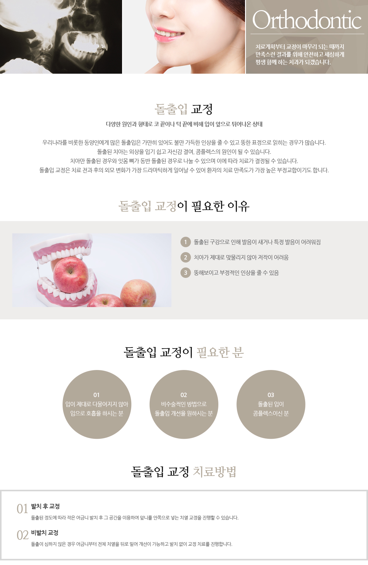 돌출입교정