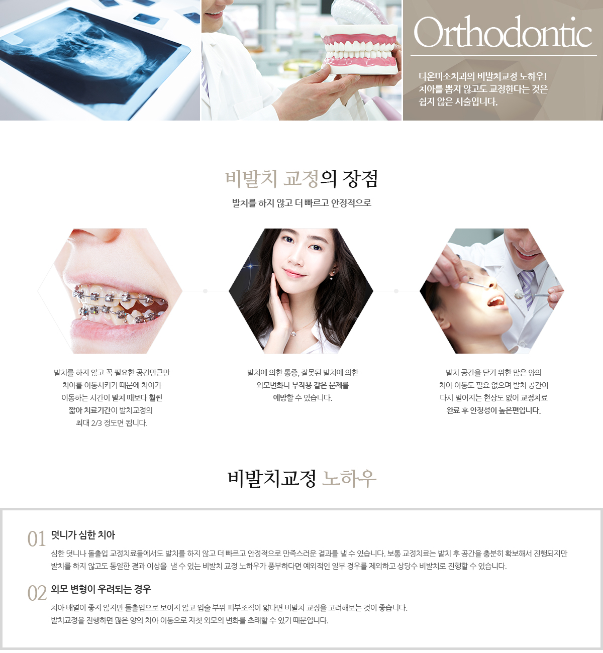 비발치 교정