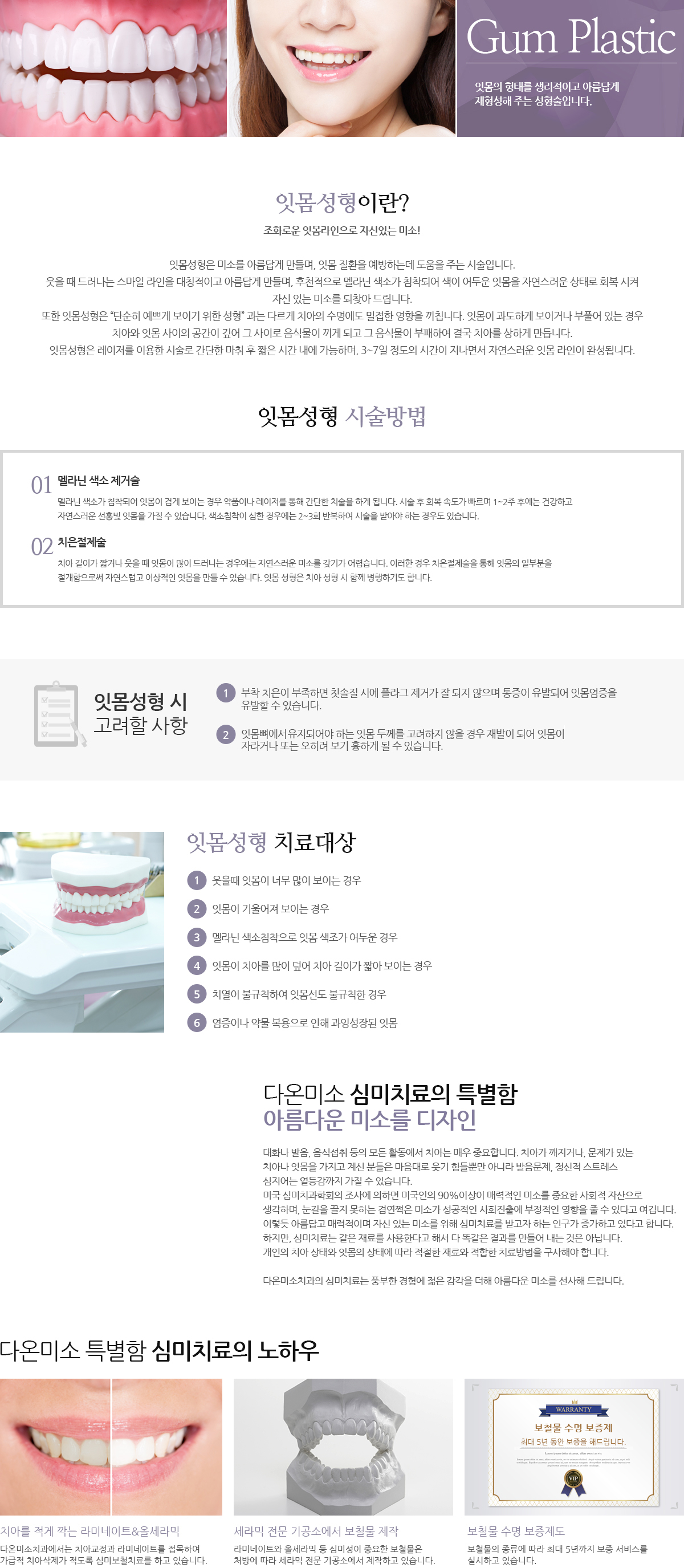 잇몸성형